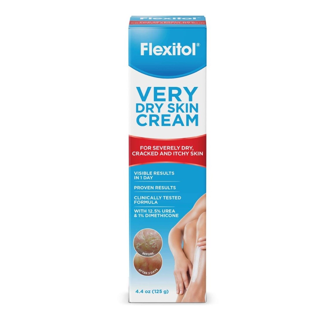 FlexitolVery Dry Skin CreamRich Moisturizing Body Cream with Urea 44 Ounce Tube