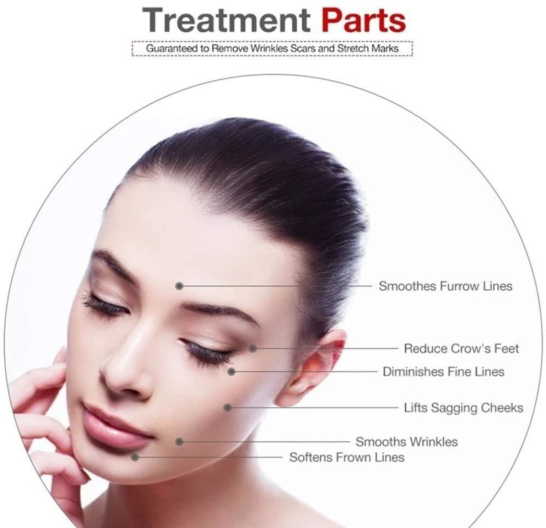 Movov 6 In 1 Derma Roller Kit 540 Titanium Alloymicro Needles Roller 0.25mm / 0.5mm / 1.0mm For Hair Regrowth Face And Body Skin Care Acne Pores Anti Aging Wrinkle Removal