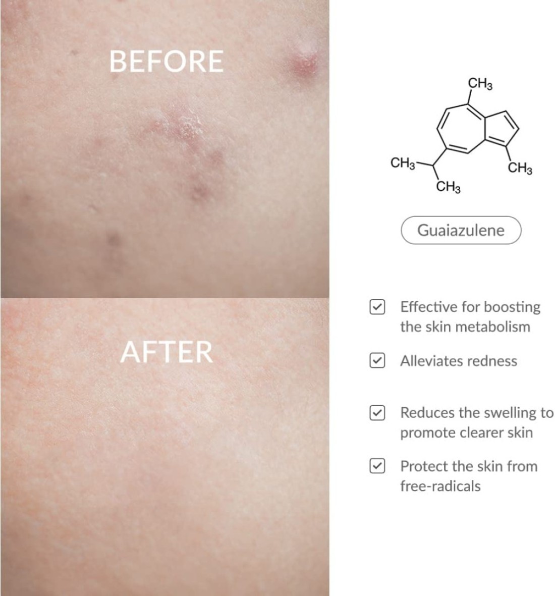 Dr.Althea Azulene 147Ha, Intensive Soothing Cream