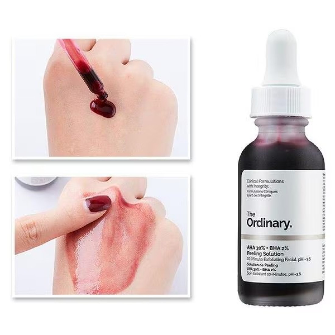 The Ordinary AHA 30% + BHA 2% Peeling Solution