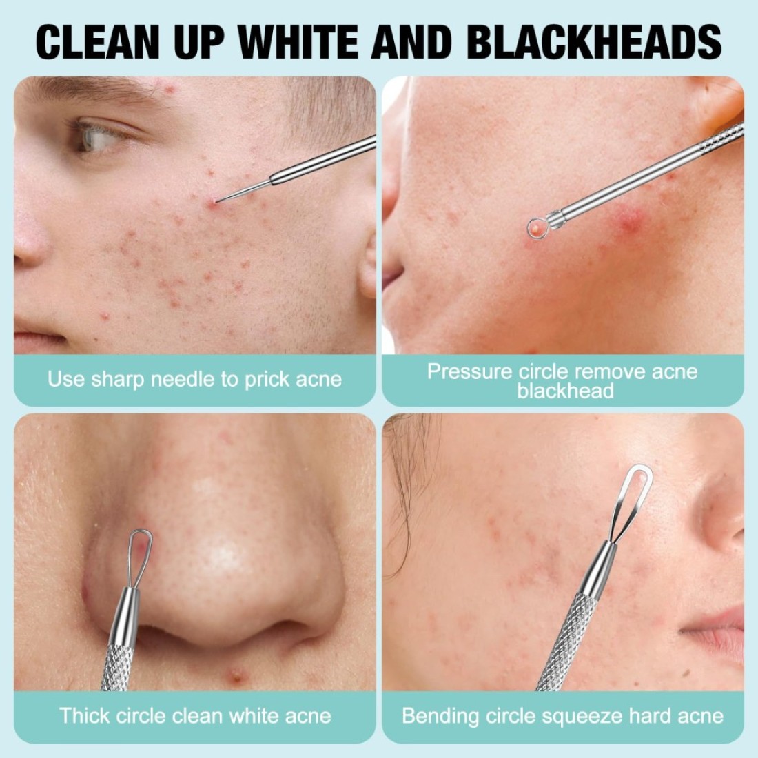 3Pcs Blackhead Remover Pimple Popper Tool Kit Pimple Extractor Acne Treatment Surgical Grade Blackhead Comedone Removal Popper Tool Cleaning Brush for Face Nose Lips