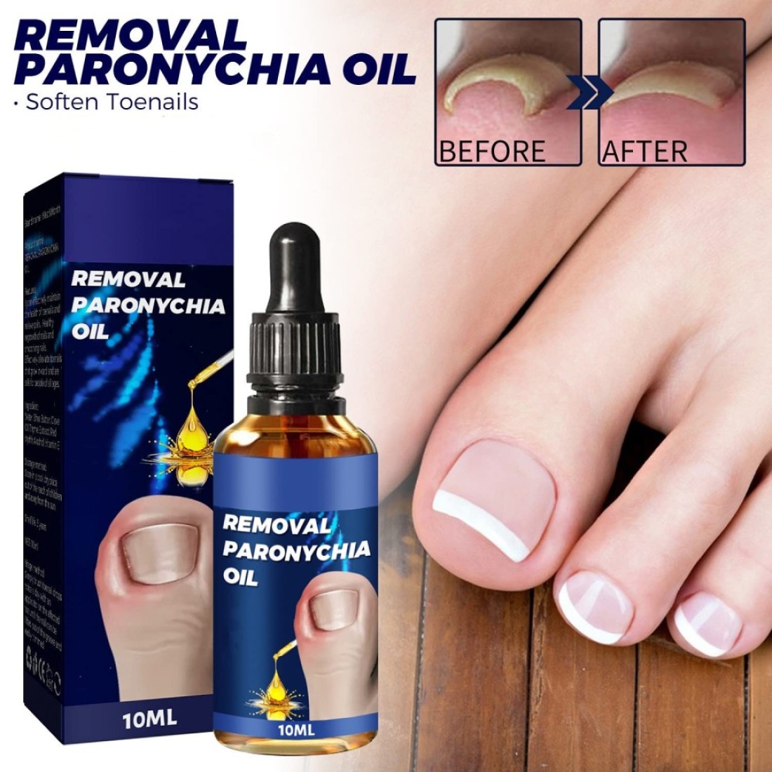 6PCs German Toenailcare Removal Paronychia Oil, Ingrown Toenail Nail Repair, German Toenailplus Oil Nail Renewal Liquid