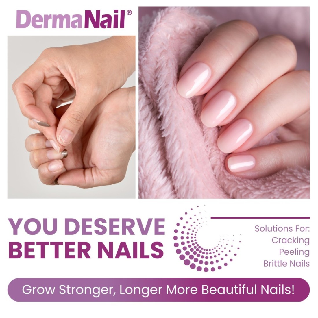 DermaNail Nail Strengthener Cuticle Cream Set Fingernail Care Kit with Liquid Nail Strengthener Cutemol Cream 115g Sample Healthy Growth Repair for Brittle Damaged Thin Peeling Nails