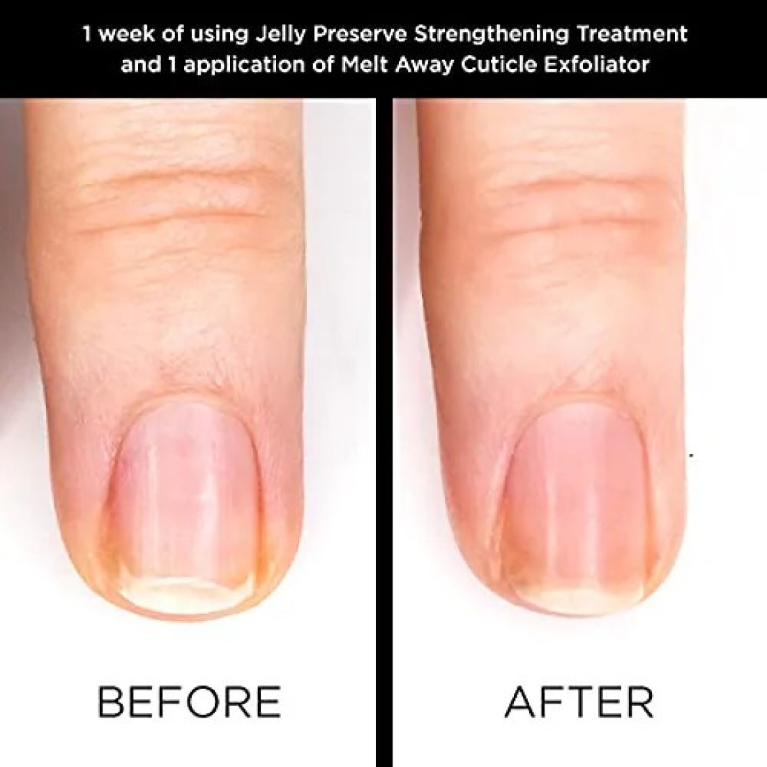Butter London Melt Away Cuticle Exfoliator, Cuticle Remover For Healthy Looking Nails