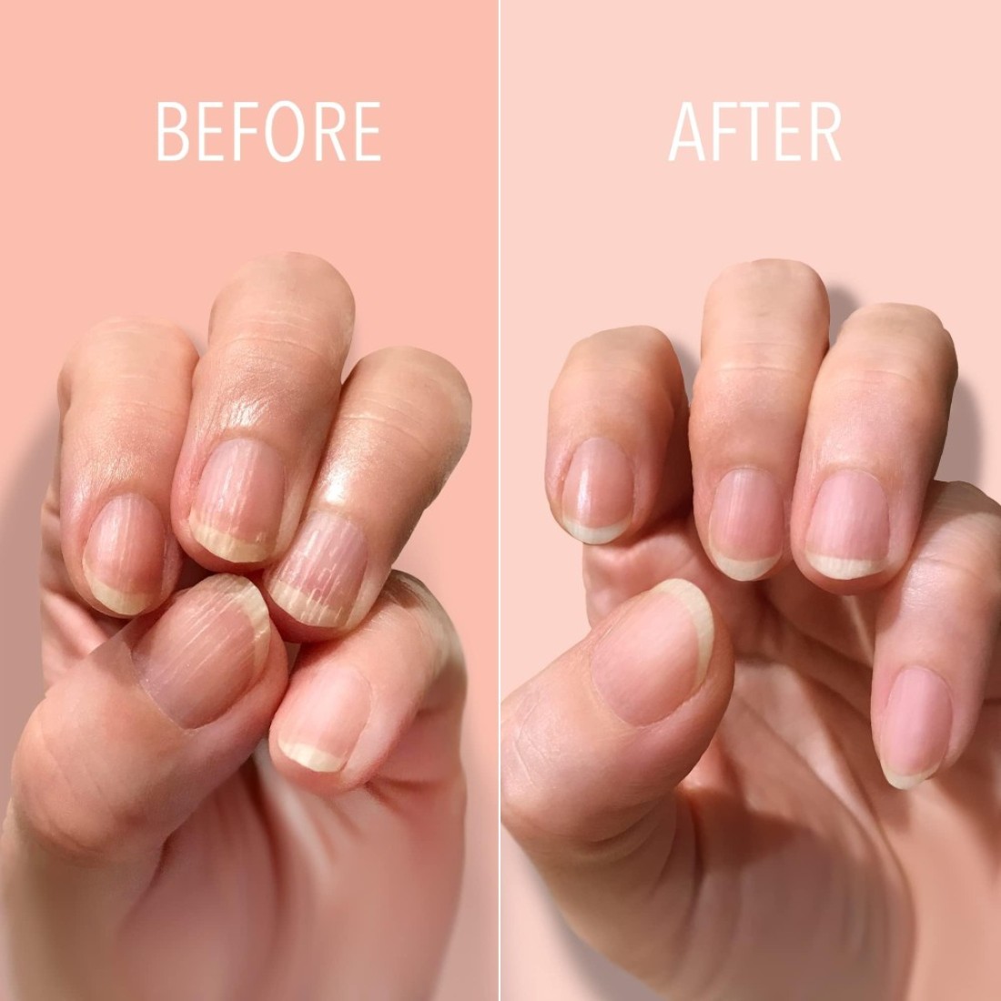 LONDONTOWN Kur Nail Ridge Filler Smoother Strengthener Nail Filler for Damaged Nails Fortifying Self Leveling Base Vegan Cruelty Free Paraben Free Clear 04 fl oz