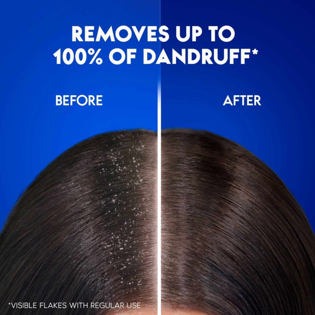Head &amp; Shoulders Classic Clean Anti-Dandruff Shampoo 1000ml Pack of 2