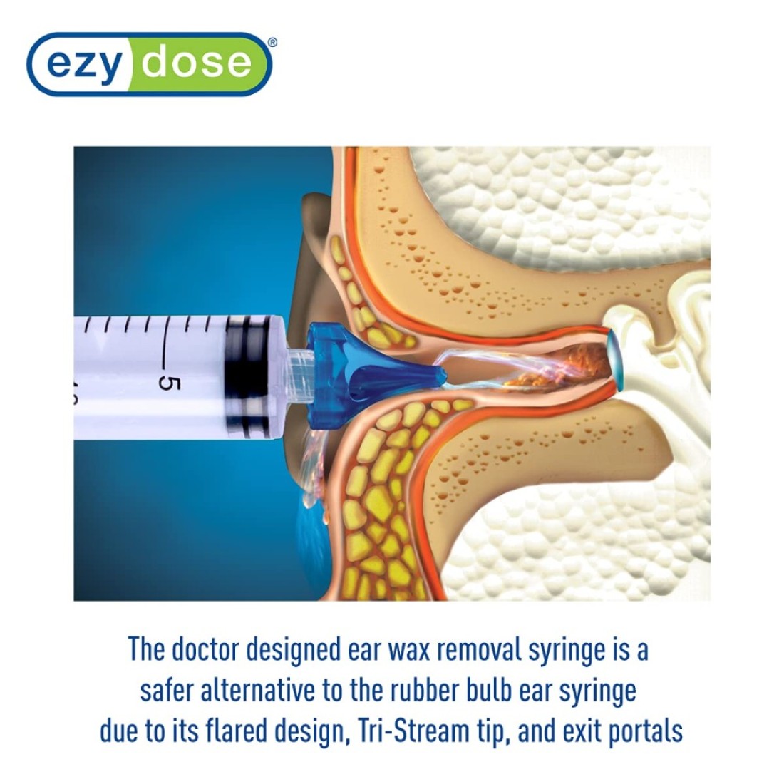 EZY DOSE Ear Wax Removal Syringe TriStream Tip Prevents Ear Infections Safe and Effective Easy to Use Perfect for Kids and Adults 20mL Capacity Clear BPA Free