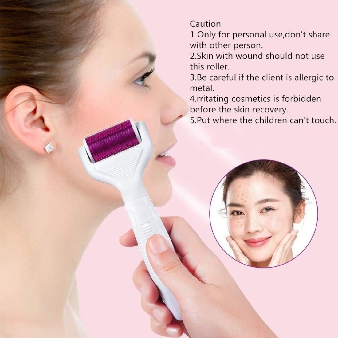 Movov 6 In 1 Derma Roller Kit 540 Titanium Alloymicro Needles Roller 0.25mm / 0.5mm / 1.0mm For Hair Regrowth Face And Body Skin Care Acne Pores Anti Aging Wrinkle Removal