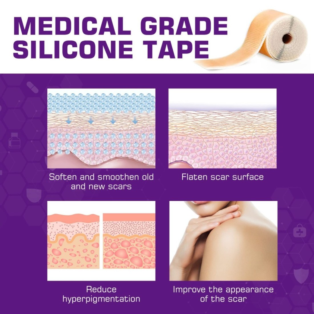 Silicone Scar Sheets16 x 60Roll15M Soft Silicone Gel Scar Tape Painless Silicone Tape Roll Reusable Medical Grade Silicone Scar Removal Strips for CSectio