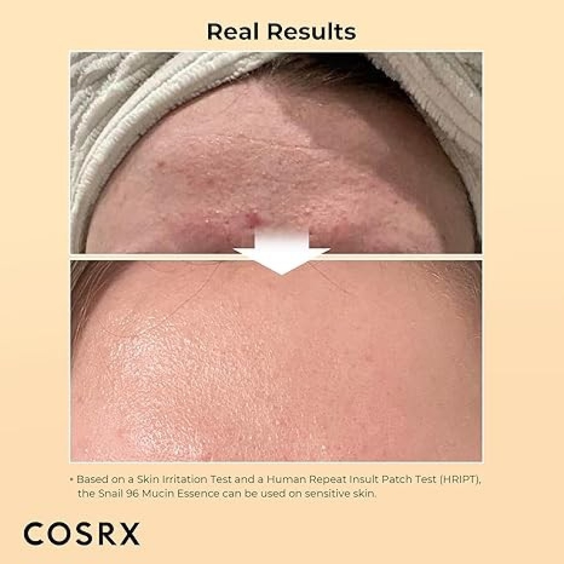 COSRX Advance Snail 96 Mucin Power Essence 100ml
