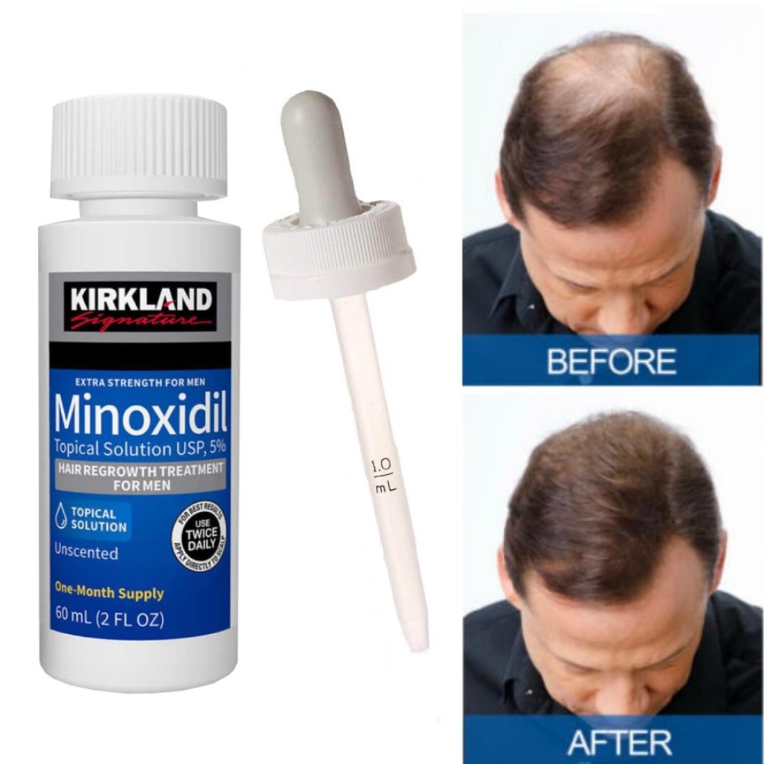 Minoxidil Extra Strength Hair Regrowth Treatment 60ml