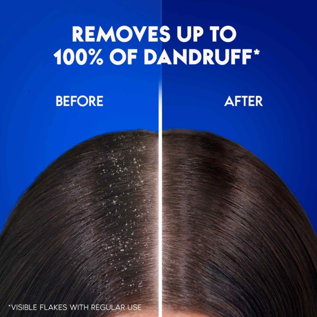 Head &amp; Shoulders Men Hairfall Defense Anti-Dandruff Shampoo 600ml