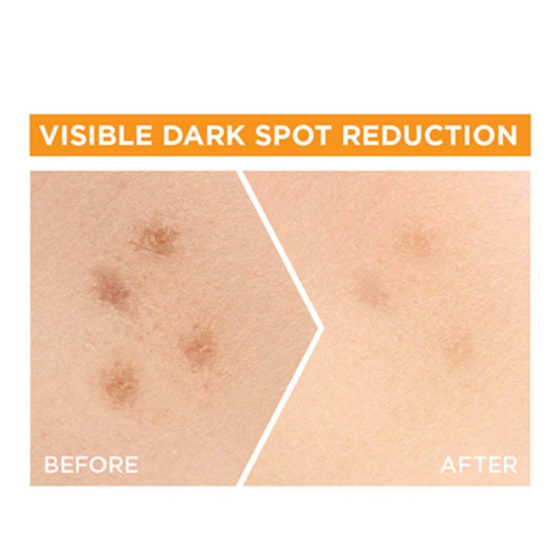 Garnier SkinActive Fast Bright 30x Vitamin C &amp; Niacinamide Anti Dark Spot Serum 30ml