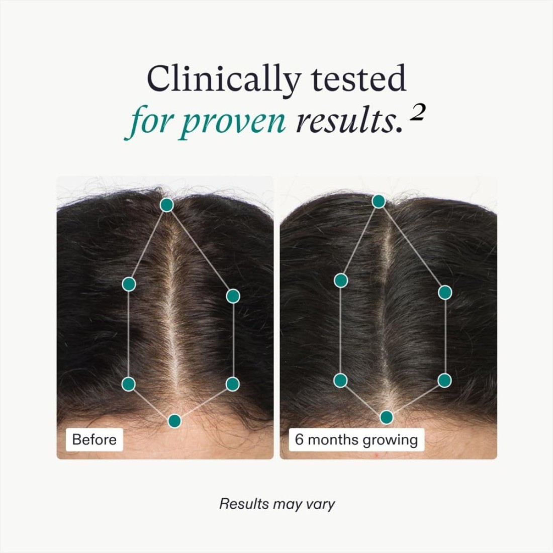 Nutrafol Womens Hair Growth Supplements Ages 1844 Clinically Proven for Visibly Thicker and Stronger Hair Dermatologist Recommended 1 Month Supply