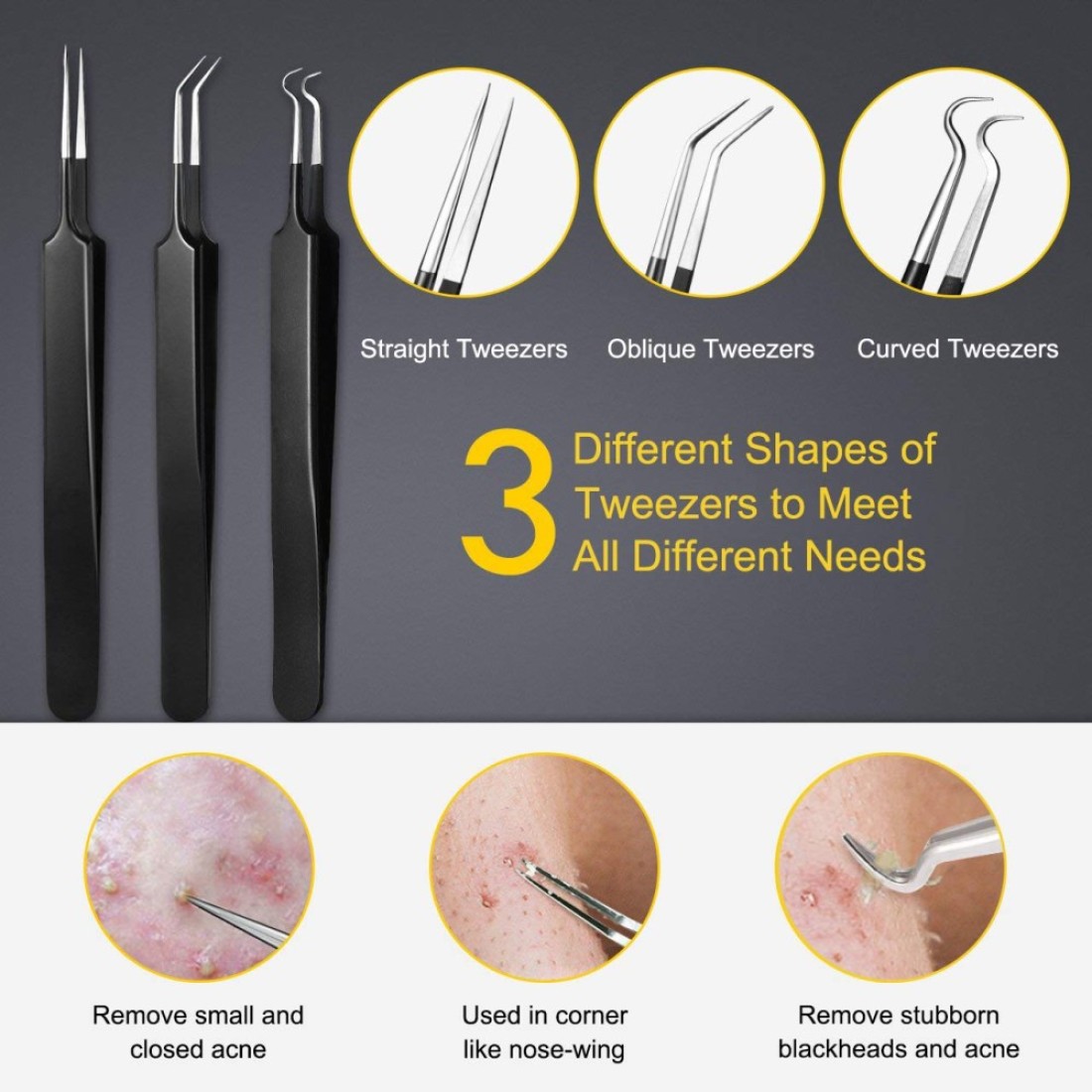 Pimple Popper Tool Kit Boxoyx 10 Pcs Blackhead Remover Comedone Extractor Kit with Box for Quick and Easy Removal of Pimples Blackheads Zit Removing ForeheadFacial and Nose Black
