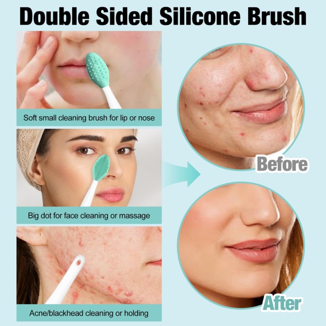 3Pcs Blackhead Remover Pimple Popper Tool Kit Pimple Extractor Acne Treatment Surgical Grade Blackhead Comedone Removal Popper Tool Cleaning Brush for Face Nose Lips
