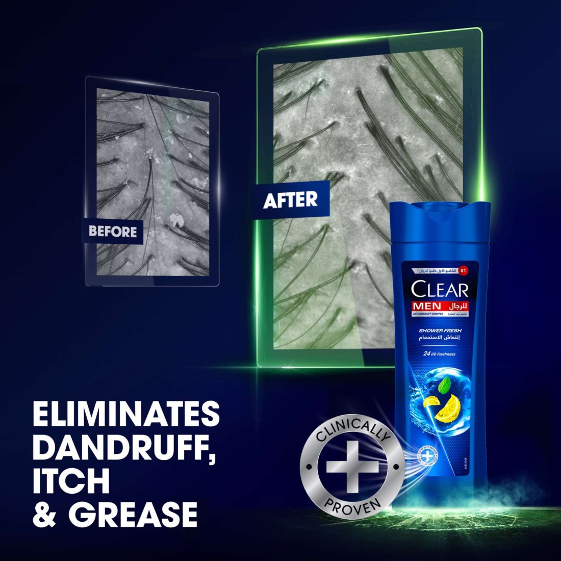Clear Shampoo For Men Anti Dandruff Shampoo Shower Fresh 400ml