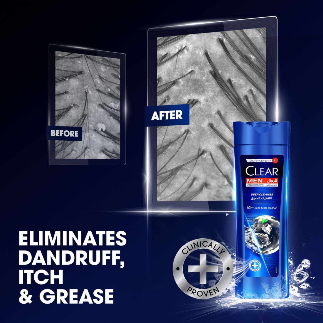 Clear Shampoo For Men Anti Dandruff Shampoo Deep Cleanse 400ml