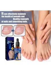 6PCs German Toenailcare Removal Paronychia Oil, Ingrown Toenail Nail Repair, German Toenailplus Oil Nail Renewal Liquid
