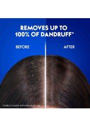 Head &amp; Shoulders Men Hairfall Defense Anti-Dandruff Shampoo 600ml