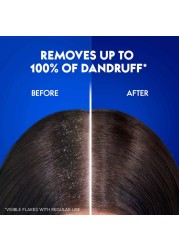 Head &amp; Shoulders Classic Clean Anti-Dandruff Shampoo For Normal Hair 1L