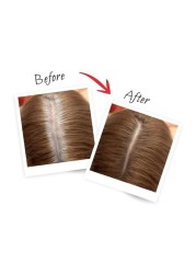 L&#39;Oreal Paris Magic Retouch Instant Root Concealer Spray Dark Blonde 75ml